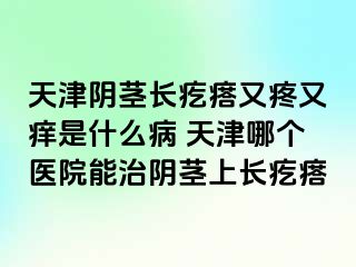 天津阴茎长疙瘩又疼又痒是什么病 天津哪个医院能治阴茎上长疙瘩