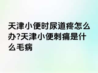 天津小便时尿道疼怎么办?天津小便刺痛是什么毛病